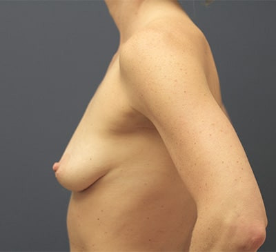2069-imageset_3-before