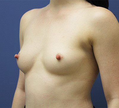 2096-imageset_2-before