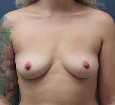 2097-imageset_1-before