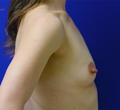2098-imageset_2-before