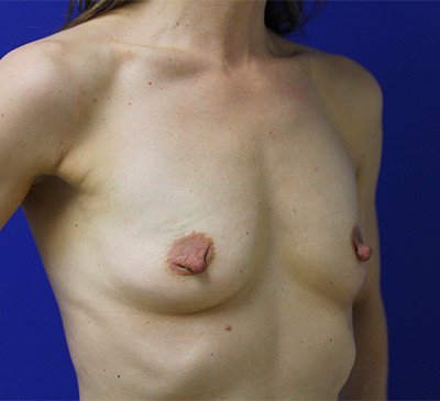 2098-imageset_3-before
