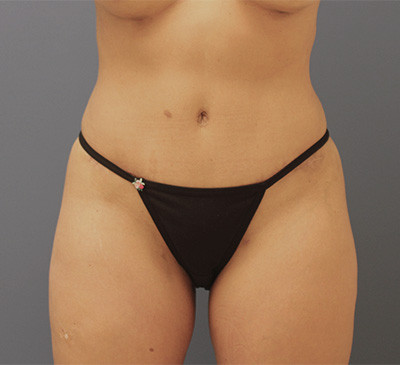 2130-imageset_1-after