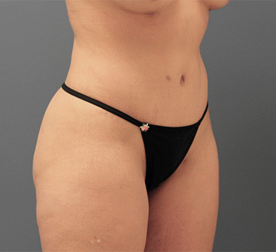 2130-imageset_2-after