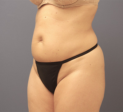 2131-imageset_2-before