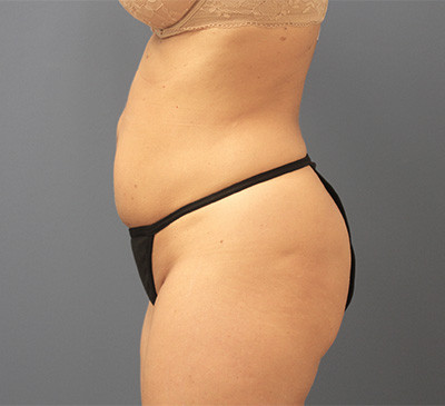 2131-imageset_3-before
