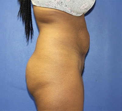 2153-imageset_3-before
