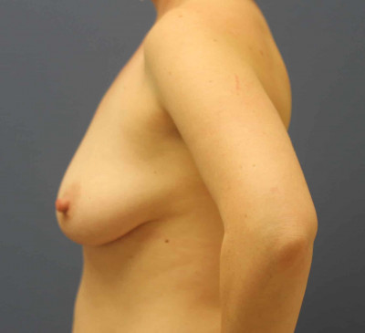 2536-imageset_3-before