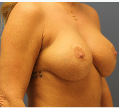 2586-imageset_2-before