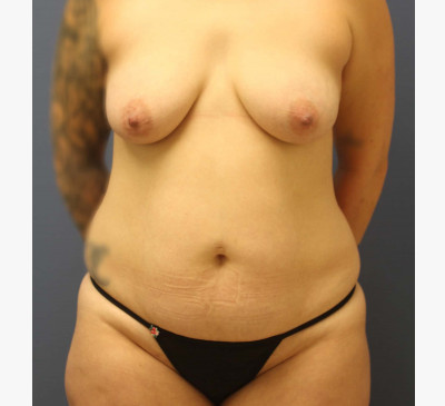2595-imageset_1-before