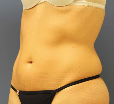 2625-imageset_2-before