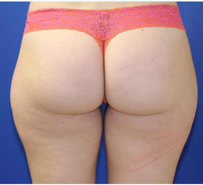 2636-imageset_1-before