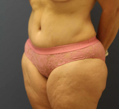 2656-imageset_2-after