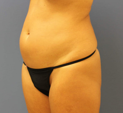 2748-imageset_2-before