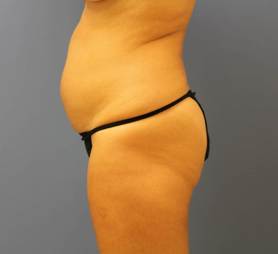 2748-imageset_3-before