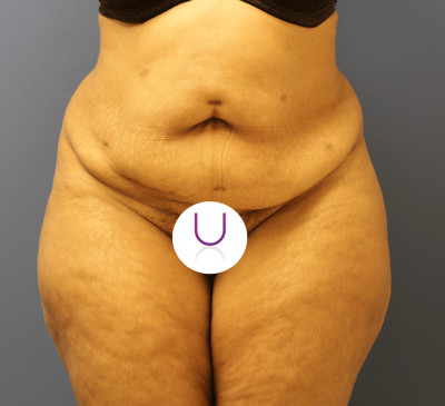 2779-imageset_1-before