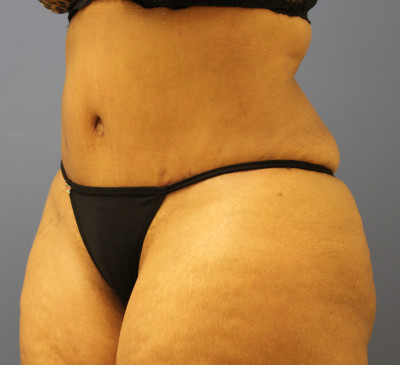 2779-imageset_2-after