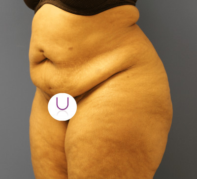 2779-imageset_2-before
