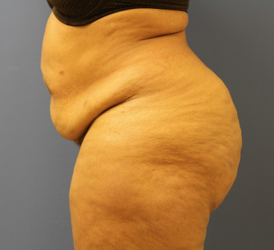 2779-imageset_3-before