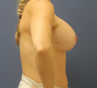 2794-imageset_3-after