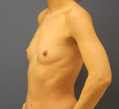 2825-imageset_2-before