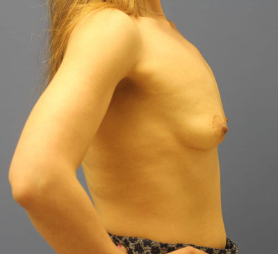 2838-imageset_3-before