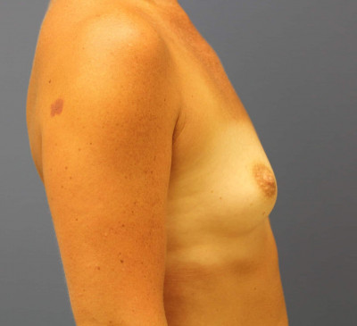 2865-imageset_3-before