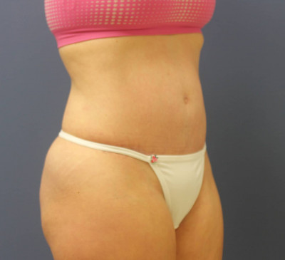 2879-imageset_2-after