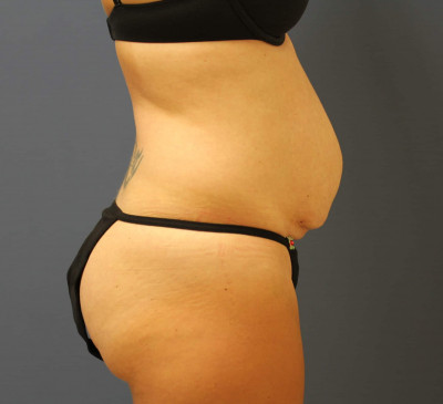 2879-imageset_3-before