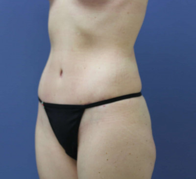 2887-imageset_2-after
