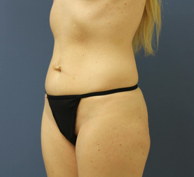 2887-imageset_2-before
