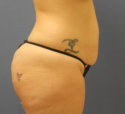 2895-imageset_3-before