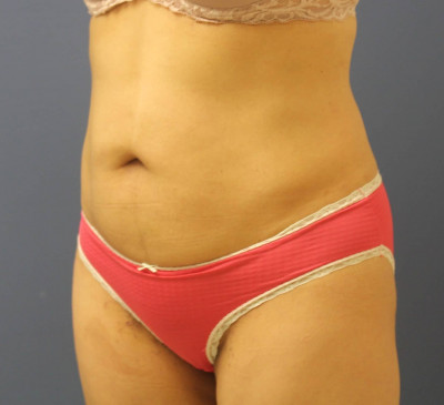 2903-imageset_2-after