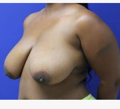 2959-imageset_2-before