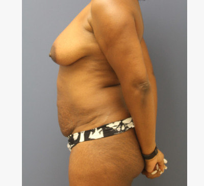 3018-imageset_2-before