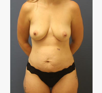 3059-imageset_1-before