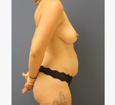 3059-imageset_3-before