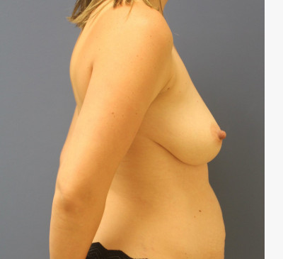 3067-imageset_3-before
