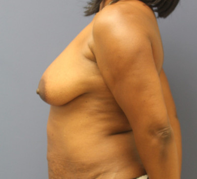 3088-imageset_2-before