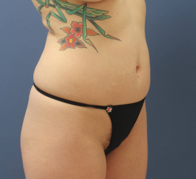 3140-imageset_2-before