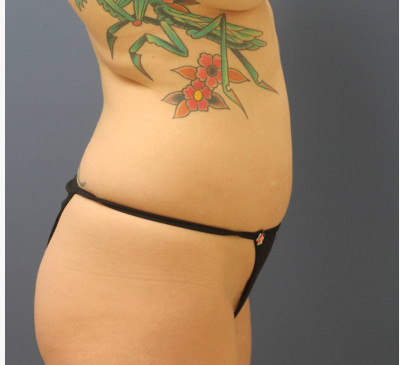 3140-imageset_3-before