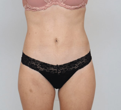 3159-imageset_1-after