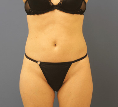 3159-imageset_1-before
