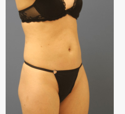 3159-imageset_2-before