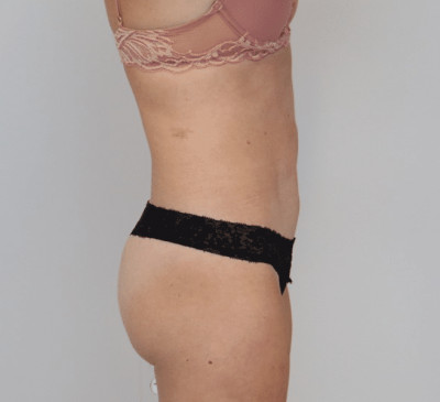 3159-imageset_3-after