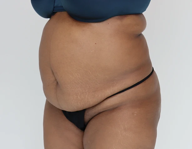 3216 front oblique-before