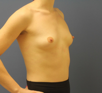 3388-imageset_2-before