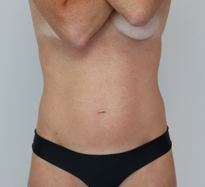 3474-imageset_1-before