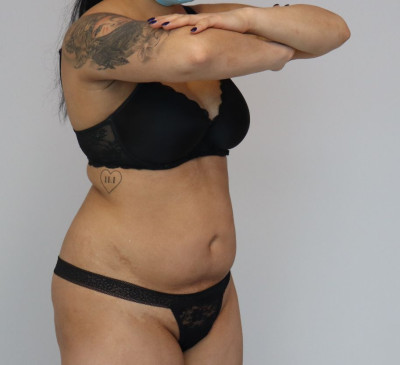 3519-imageset_3-before