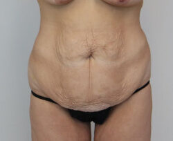 3544-imageset_1-before