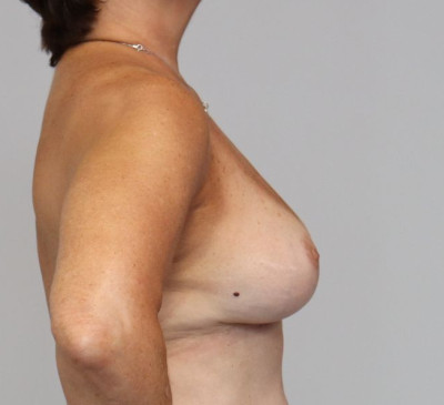 3613-imageset_3-after